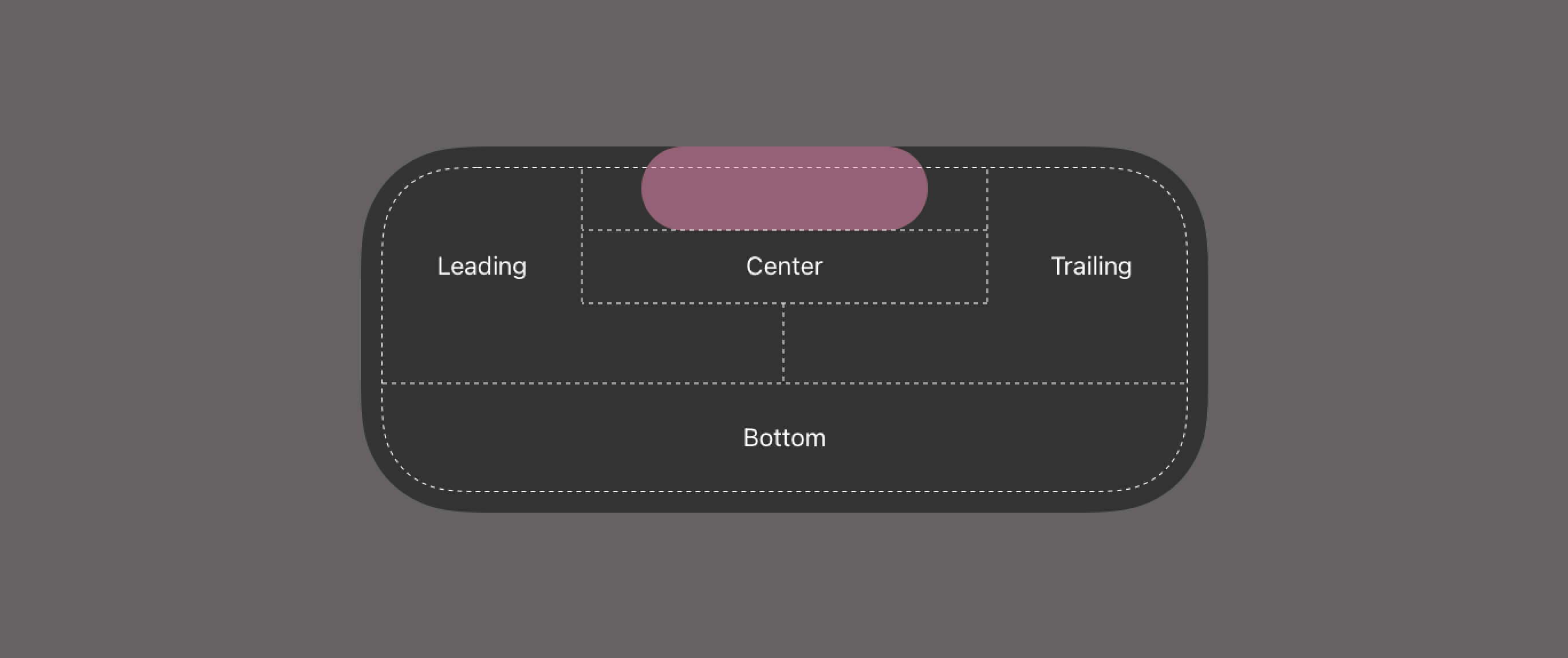 iOS Live Activity Expanded view